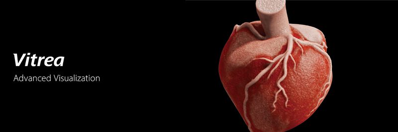 Vitrea Advanced Visualization